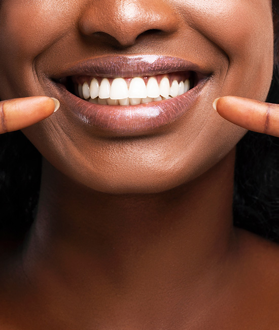 The image features a close-up of a person with a radiant smile, showcasing their teeth and lipstick.
